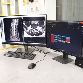 Zväčšiť fotografiu - V trenčíne pribudla moderná magnetická rezonancia - IMG_8302