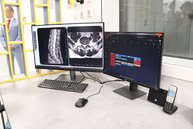 Zväčšiť fotografiu - V trenčíne pribudla moderná magnetická rezonancia - IMG_8302