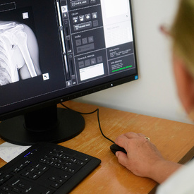 Dlhé čakacie doby na mamografické vyšetrenie či röntgen sú v myjavskej nemocnici minulosťou